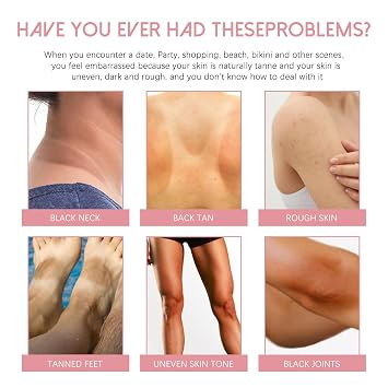 Crema Reparadora Para Manchas Oscuras 50ml, Crema intima para mujeres, Adecuado para varias areas como cara, axilas, cuello, zona privada
