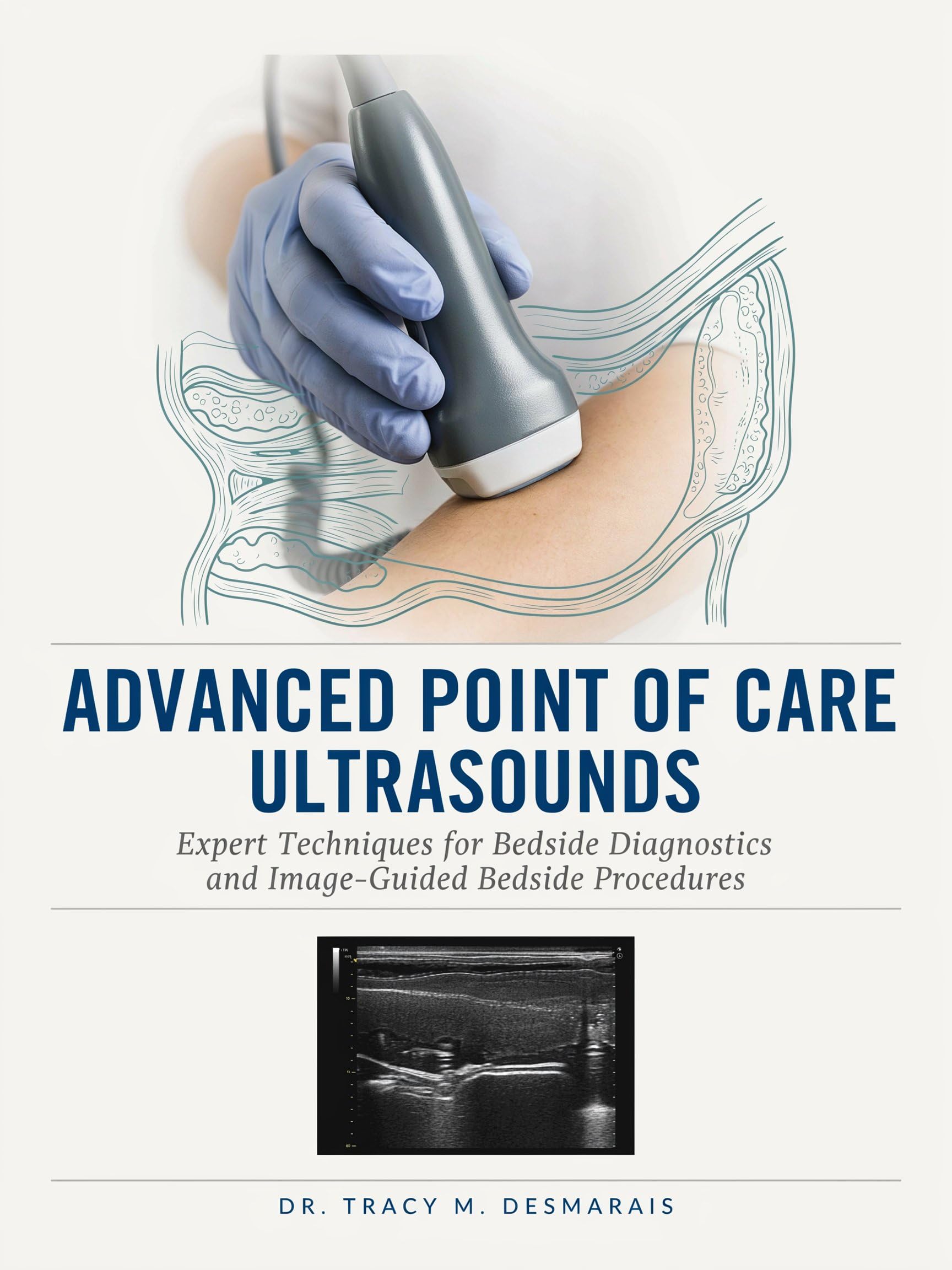 ADVANCED POINT OF CARE ULTRASOUNDS: Expert Techniques for Bedside Diagnostics and Image-Guided Bedside Procedures (English Edition)