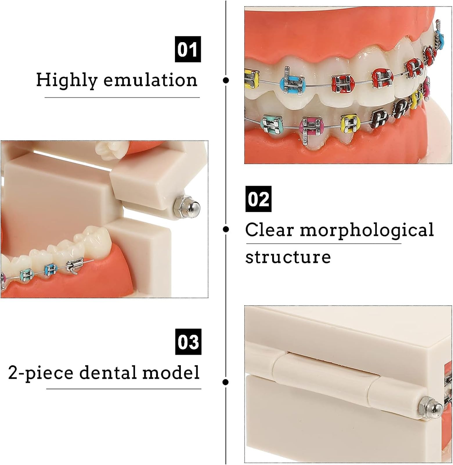 Modello dimostrativo ortodontico Dentale con Attacco Metallico Standard per Il Trattamento dei Denti, Modello di insegnamento, Studio e spiegazione