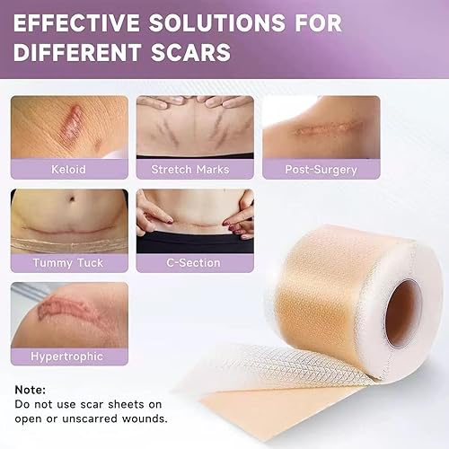 Miniatura 4 de Cinta de silicona para cicatrices, hojas de cicatriz de silicona, cinta de cicatriz para cicatrices quirúrgicas, tiras de silicona para cirugía,
