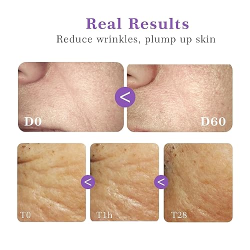 Miniatura 2 de JING MENG Matrixyl 3000 Argireline Suero, retinol liposomal, péptidos antienvejecimiento, levantamiento instantáneo firme, suero de péptidos de