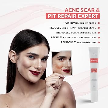 AcneScar Advanced Gel for Acne Scars & Acne Pits| Help to Reduce Old & New Scar| Reduces Pigmentation| Fights Acne & Blackheads | Suitable for All Skin Types for Men & Women 15g