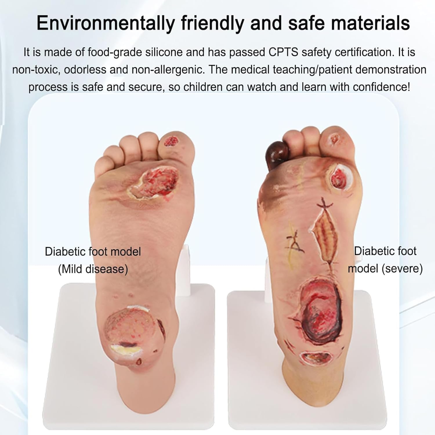 Diabetic Foot Model, Diabetic Foot Simulator Graded Foot Plate, Purulent Wound Lesions Grade(mild Disease 1~3level Or Severe 4~5level), for Anatomy, Physiology, Wound Care Severe