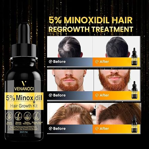 Miniatura 3 de Minoxidil para hombres, suero de crecimiento del cabello para mujeres, aceite natural para el crecimiento del cabello, desbloquea el crecimiento