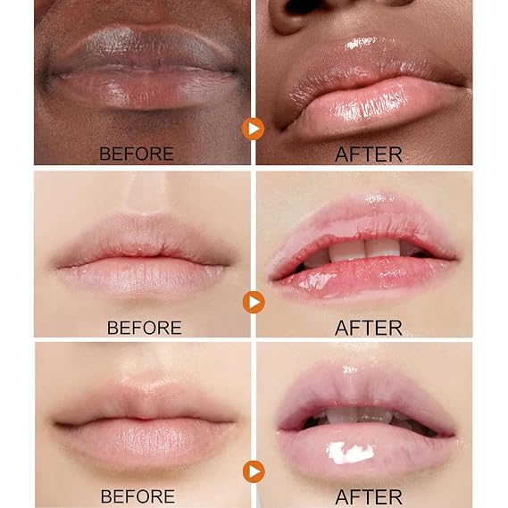 ARCHIDATE 2Pcs Turmeric Lip Balm for Dark Lips, Natural Turmeric Moisturizing Lip Balm for Smokers, Long-Lasting Moisturize Nourishes Softens Dry Chapped Dull Lips, Leaves Lips Looking Soft and Supple