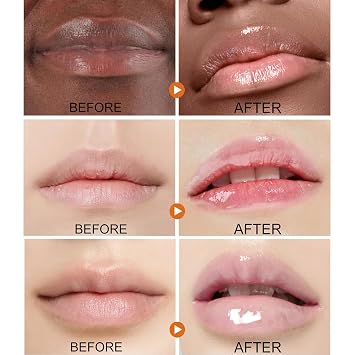 ARCHIDATE 2Pcs Turmeric Lip Balm for Dark Lips, Natural Turmeric Moisturizing Lip Balm for Smokers, Long-Lasting Moisturize Nourishes Softens Dry Chapped Dull Lips, Leaves Lips Looking Soft and Supple