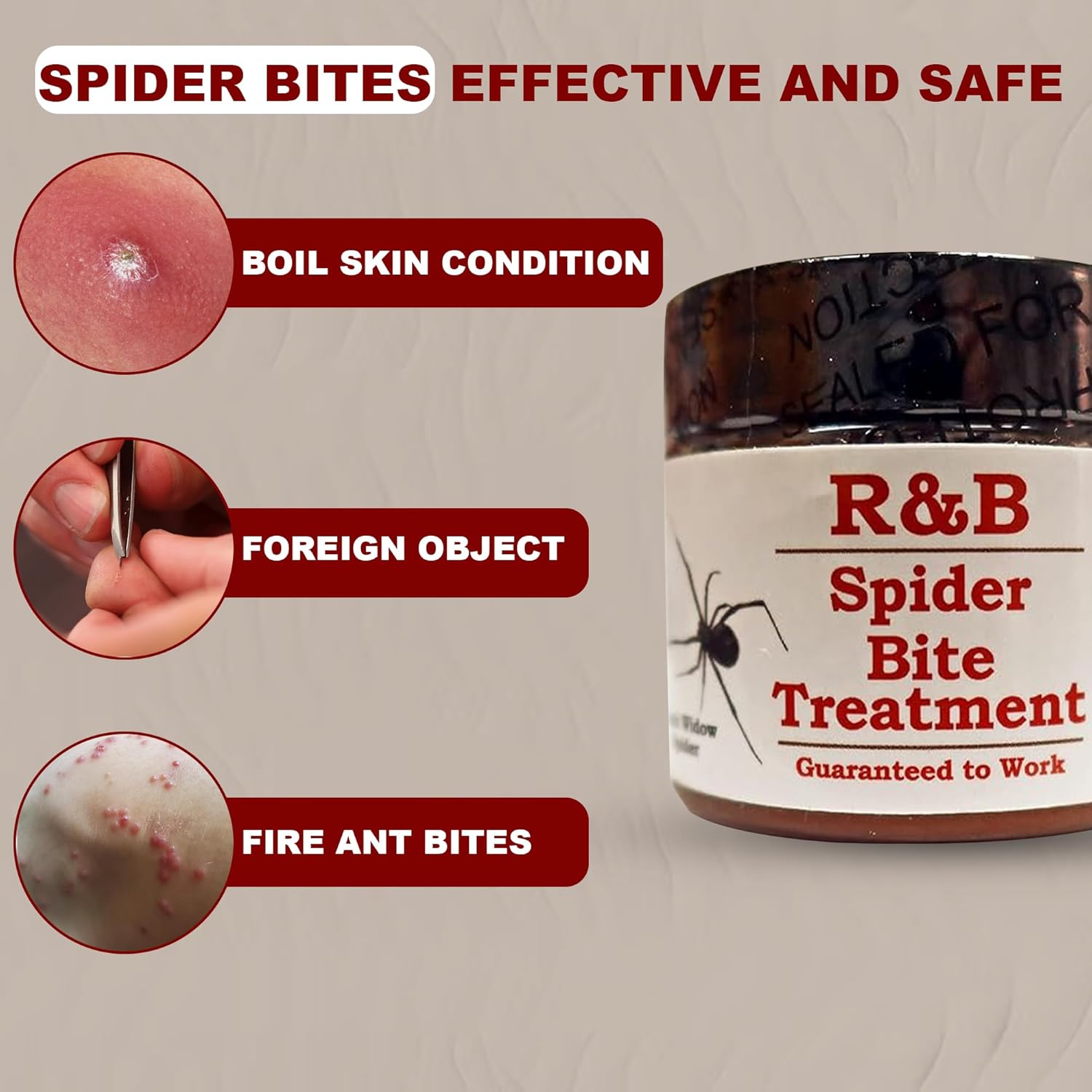 R&B Natural Spider Bite Treatment Effective for Brown Recluse, Black Widow, and Other Insect Bites | 3oz Balm