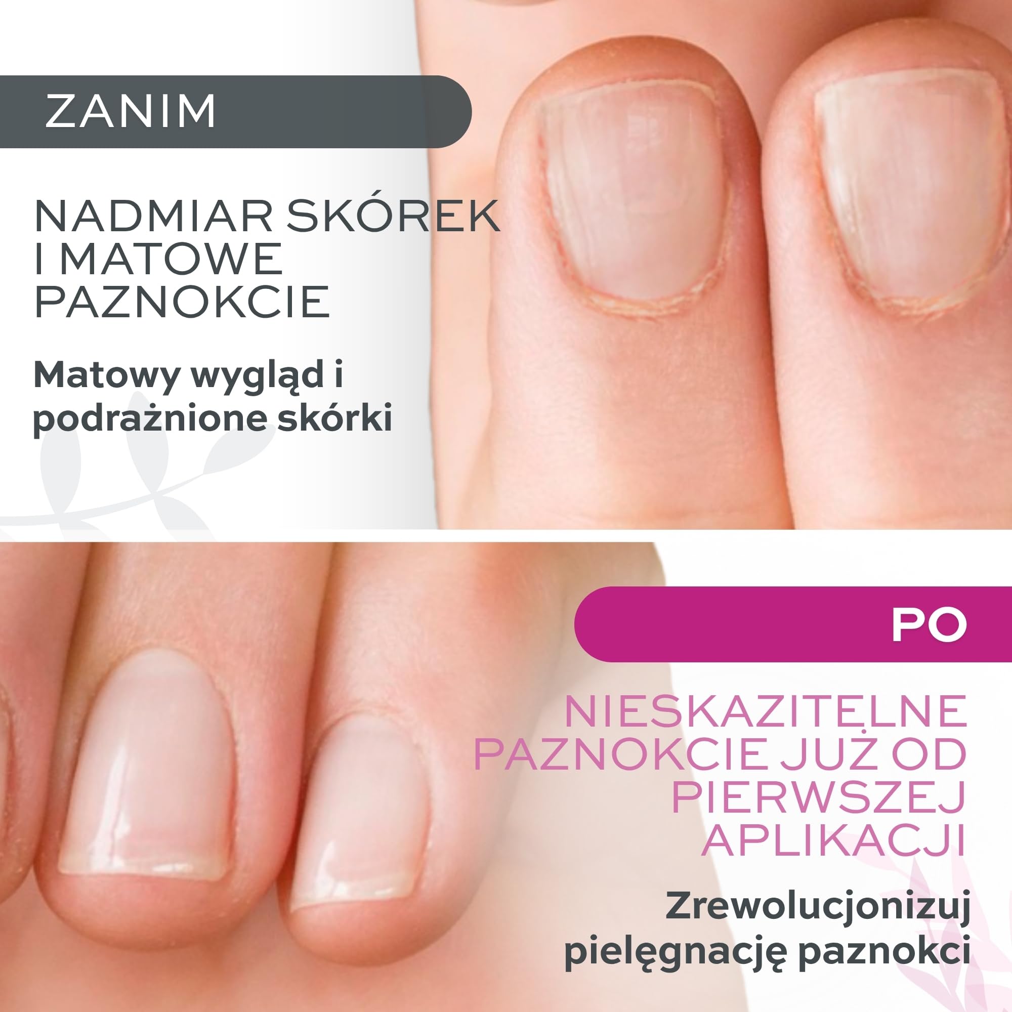 Cutiway profesjonalny środek do usuwania skórek do paznokci, 12 ml, skuteczny środek do usuwania skórek i pedicure