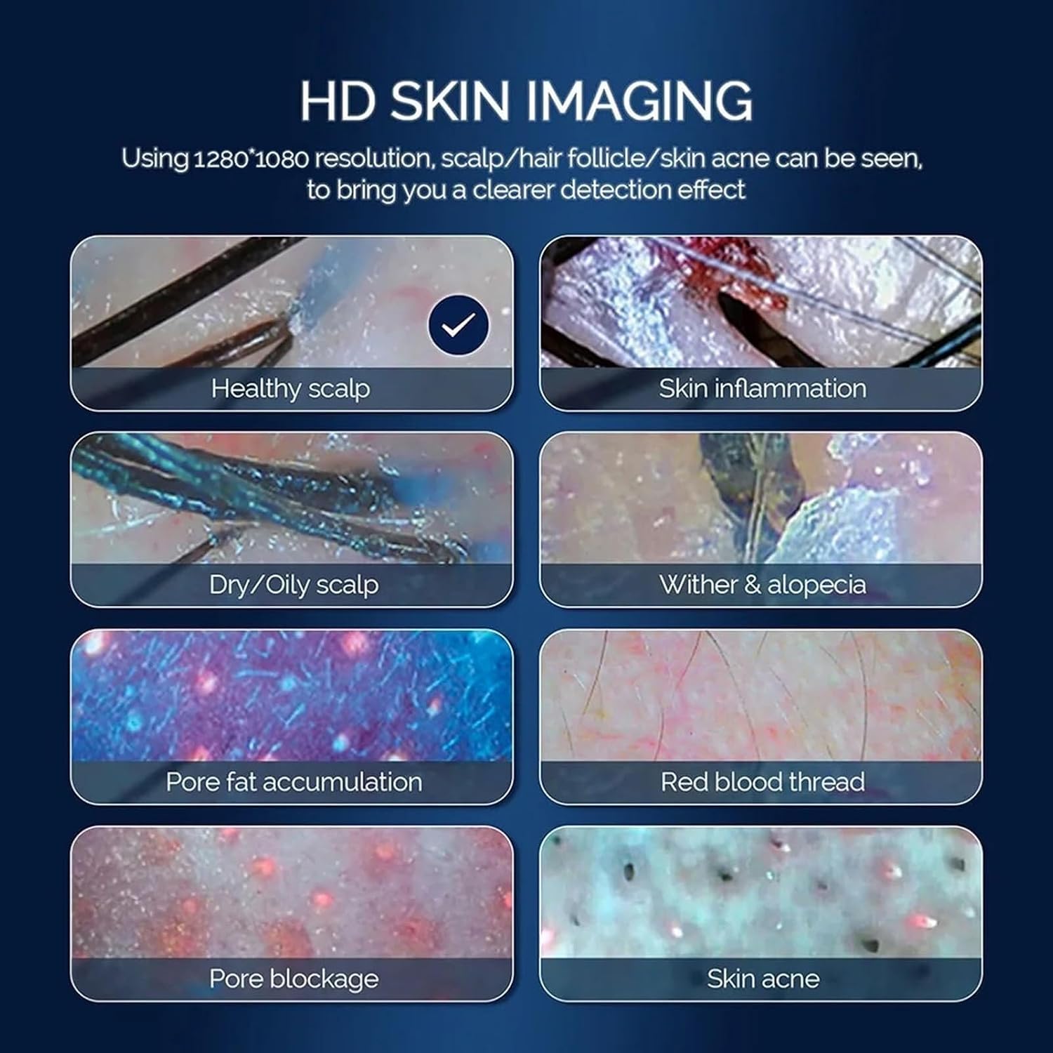 Hair Analyzer, Skin Scalp Detection Hair Follicle Analyser Machine with 50x/200x Dual Heads