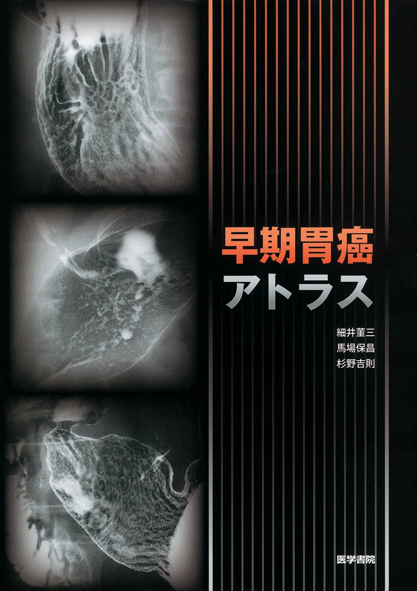 早期胃癌アトラス   /医学書院/細井董三（大型本） 早期胃癌アトラス | 細井 董三 |本 | 通販 | Amazon