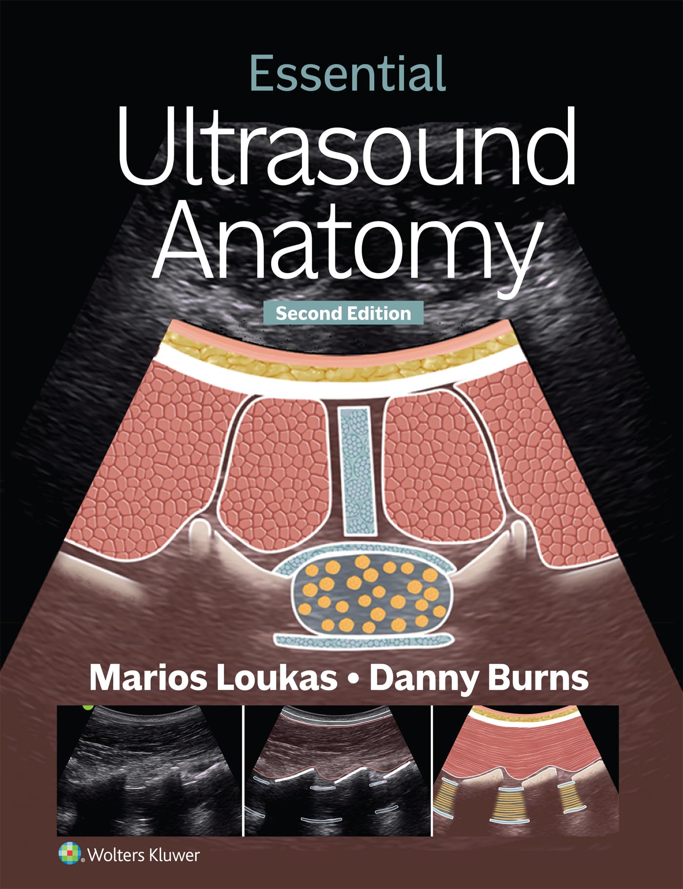 Essential Ultrasound Anatomy (English Edition)