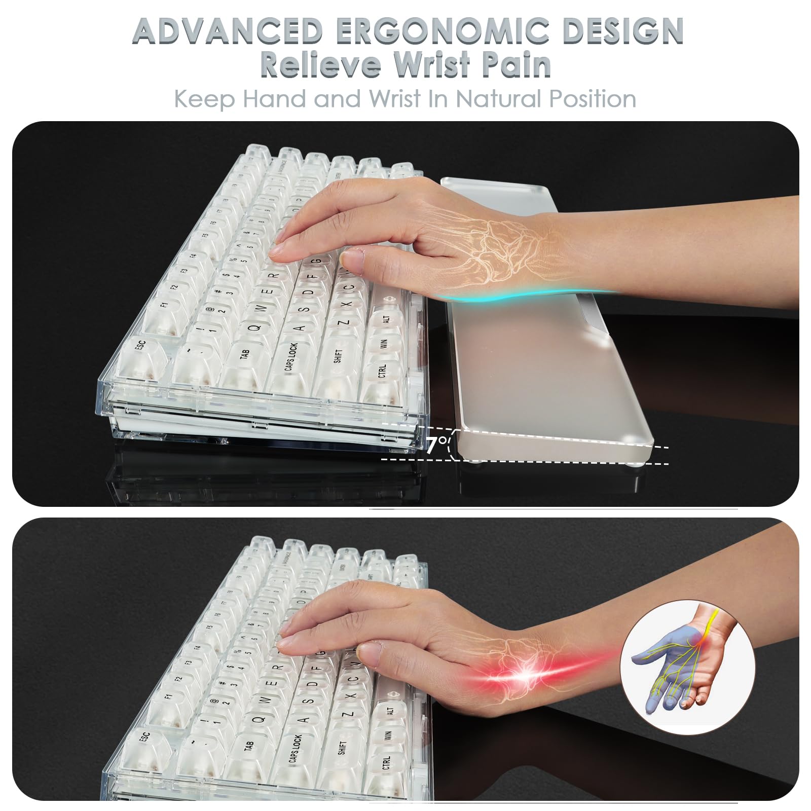 Repose-poignet en acrylique pour clavier de jeu, repose-poignet ergonomique transparent avec base antidérapante, logo personnalisé en alliage d'aluminium pour clavier d'ordinateur compact à 80 %,