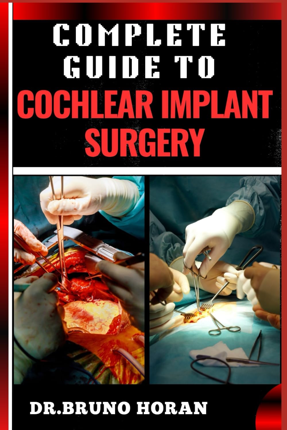 COMPLETE GUIDE TO COCHLEAR IMPLANT SURGERY: Comprehensive Manual To Advanced Techniques, Patient Care, And Optimized Outcomes For Hearing Restoration