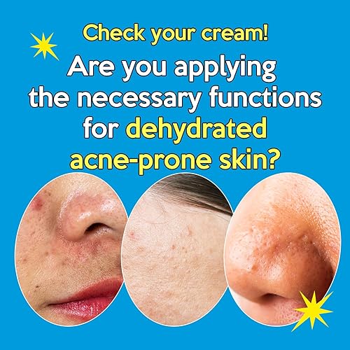 Miniatura 3 de Troubless Crema hidratante facial para aliviar el enrojecimiento coreano para la cara  Crema hidratante facial de día y noche para la combinación de