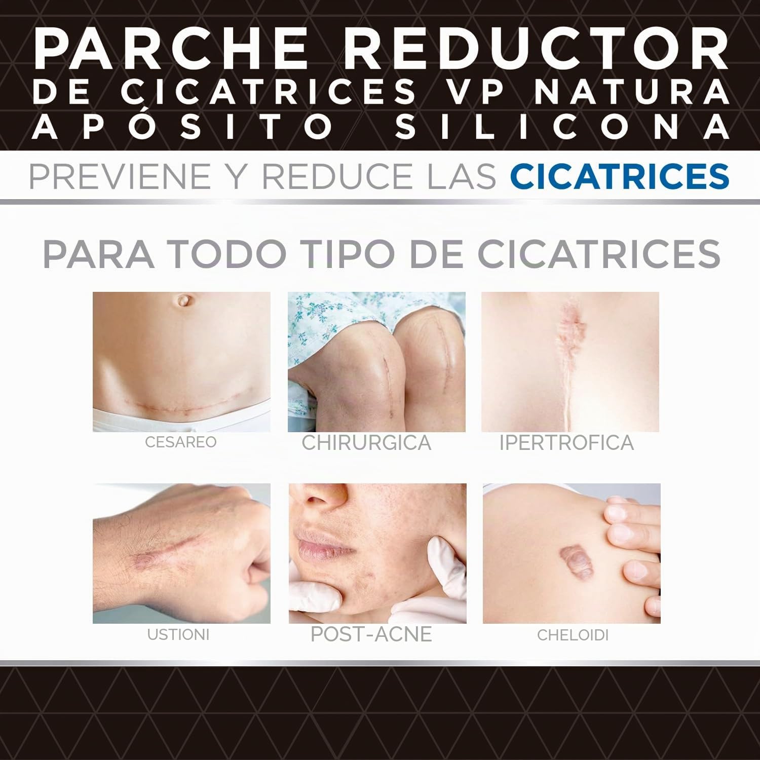 VP PHARMA Patch Cicatrici in Silicone: Aposito Cicatrizzante con adesione duratura e protezione solare, ideale per ridurre le cicatrici e accelerare il recupero. 5 toppe da 10 x 18 cm