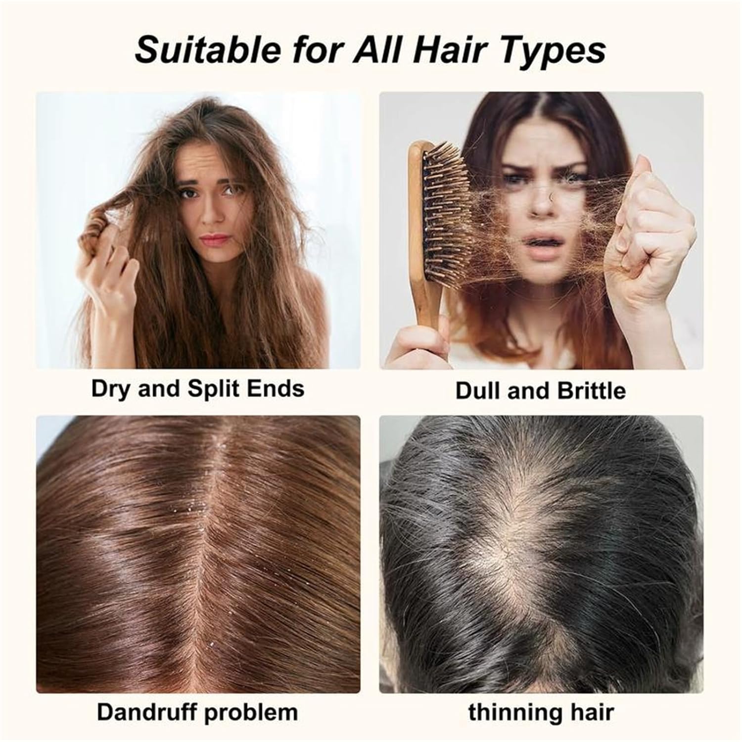 300ml Anti Hair Loss Shampoo For Women, Anti Hair Fall Hair Treatment Shampoo Oil Control Dandruff (3Pcs)