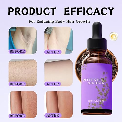 Miniatura 3 de 2 sueros para piel Cyperus Rotundus, aceite Cyperus Rotundus, esencia reparadora de depilación, aceite corporal hidratante natural, calmante y