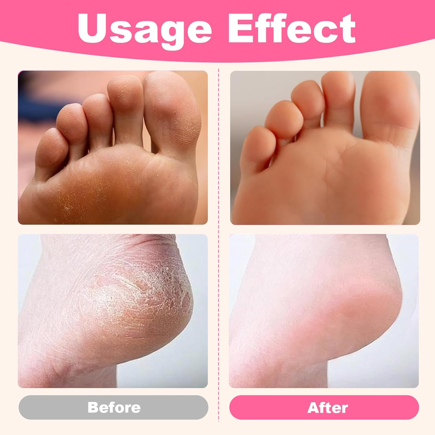 Electric Foot File, Adjustable Speed Foot Callus Remover, Callus Remover for Feet with 60 pcs Sandpaper Discs, Men Women Pedicure Tool for Dead Skin & Calluses (Black)