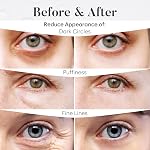 BLOOMORA Boîte de variétés sous les pamphlets des yeux (30 Pairs), masque sous les yeux pour les yeux puants, apparence de cercles sombres, lissant & Hydratation, autosoin & Cadeaux de soins pour femmes, Patch Yeux