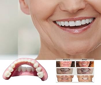 健康・医学 Best Denture Design Amazon.com: DENTUREWAY DIY Denture Kit with Impression(3