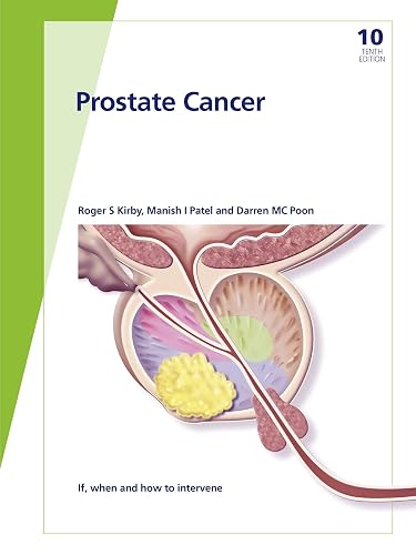 Fast Facts: Prostate Cancer: If, when and how to intervene
