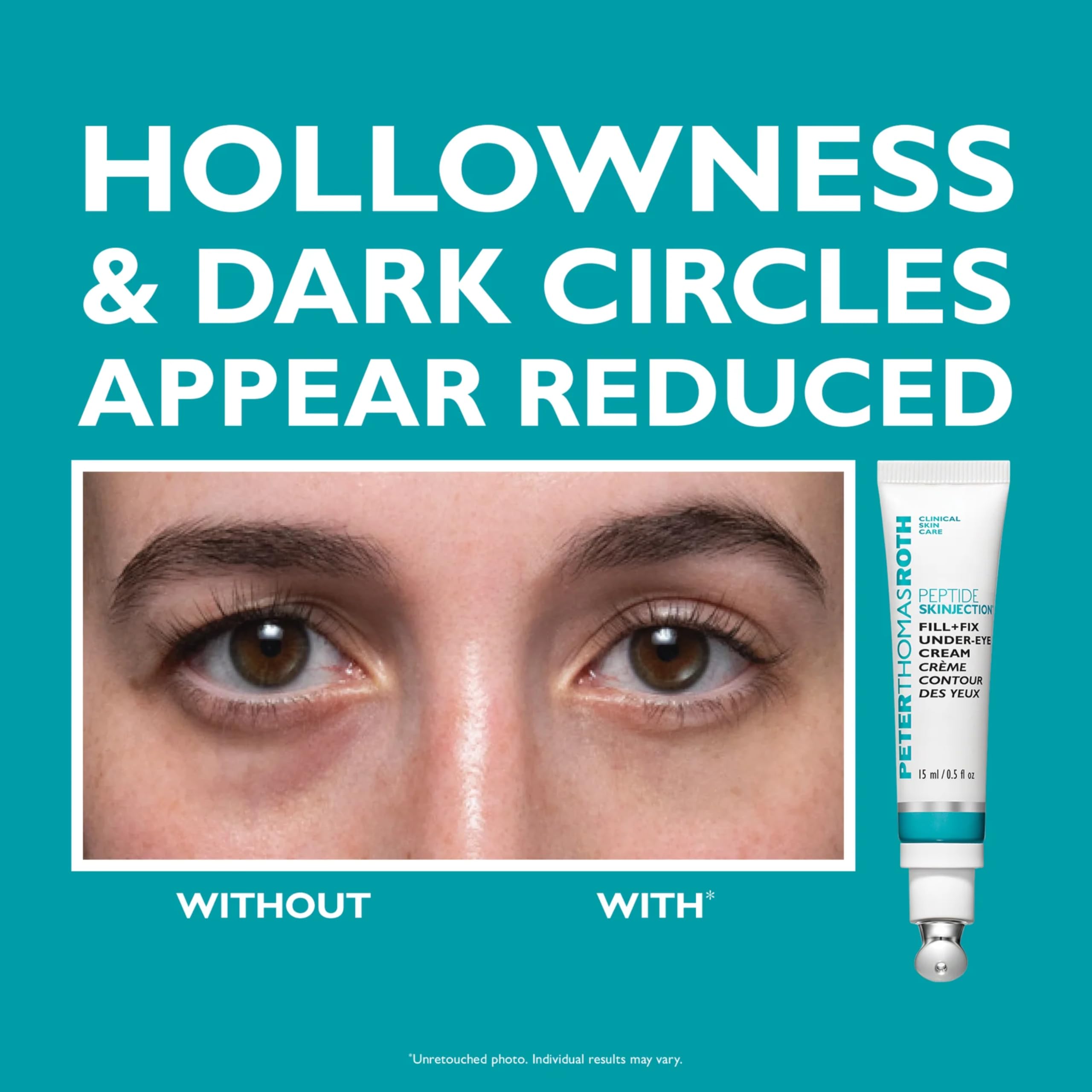 Peter Thomas Roth Peptide Skinjection™ 2-Piece Kit – Face & Eye Set mit Peptiden & Hyaluronsäure – Straffende Augencreme & Feuchtigkeitscreme – Anti-Aging Pflege für glatte Haut