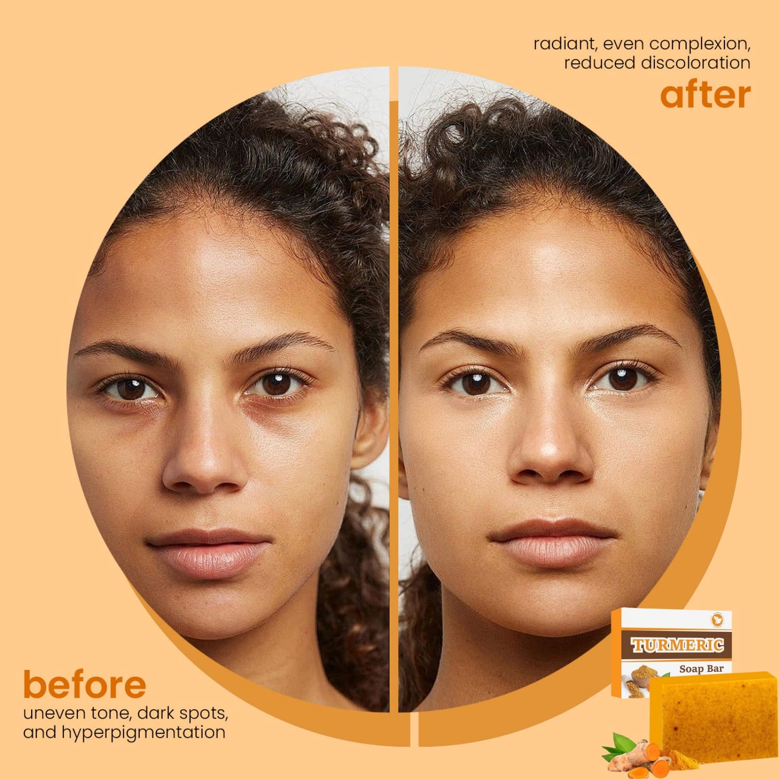 Turmeric Soap Bar, Natural Kojic Acid Soap, Turmeric and Kojic Acid Soaps, Brightens Skin - Image 3