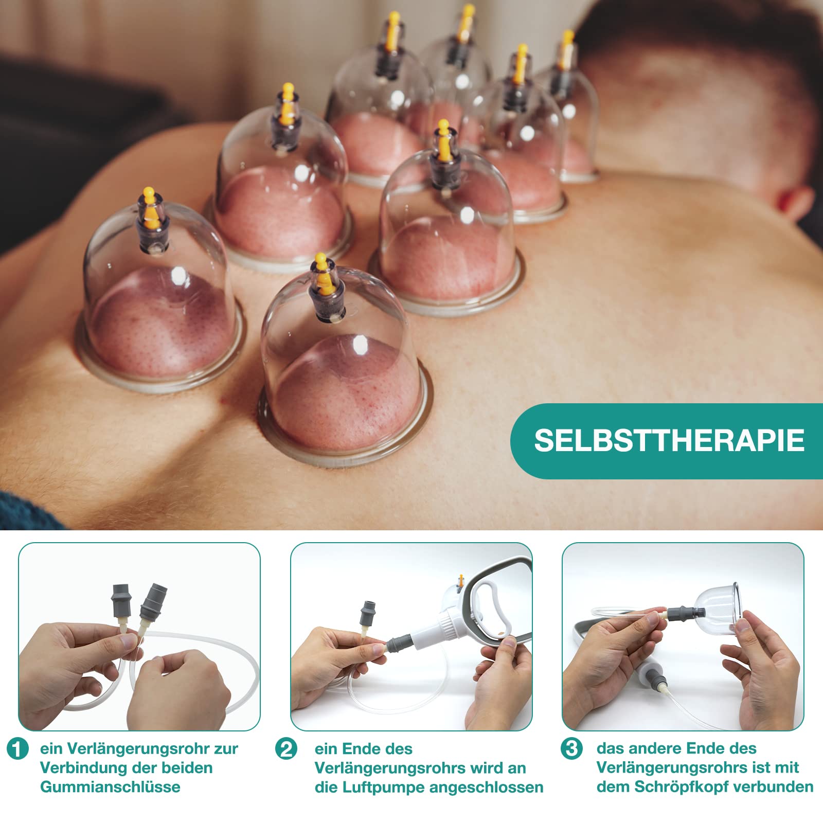Schröpfgläser mit Vakuumpumpe - Schröpfglas - Hochwertig Schröpfen (18 Stück) - Schröpfgläser Gesicht und für den ganzen Körper - Schröpfset -Cupping set