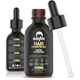 Elevate Hair Regrowth Treatment 5% Minoxidil Solution – Biotin Serum Hair Growth Oil for Men & Women - Thicker Fuller Stronger Hair - Stops Hair Loss & Thinning - Natural Hair Thickening Treatment 2oz