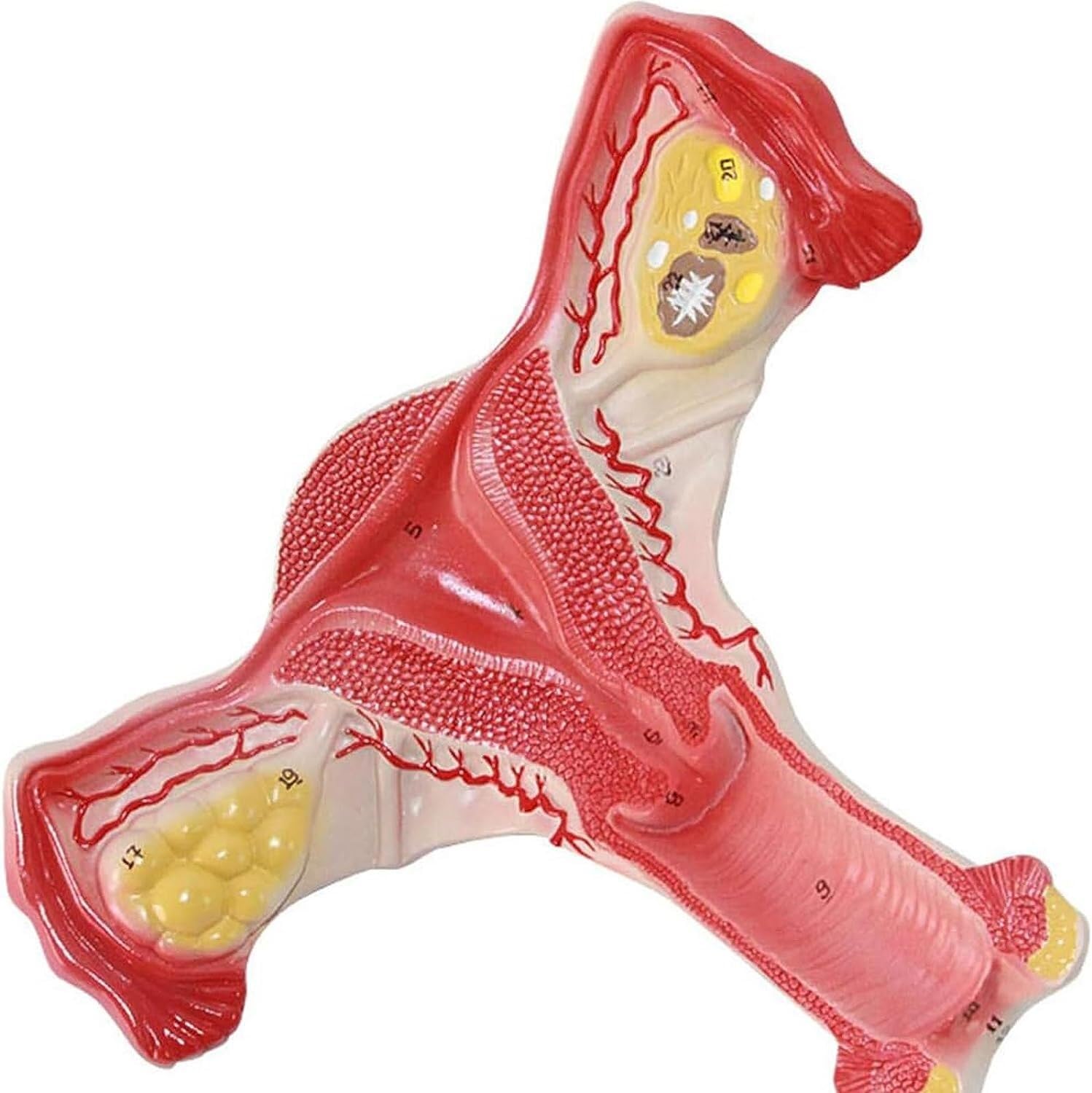 Modelo anatómico de anatomía, lesión uterina, Modelo de anatomía de órganos Humanos con órganos extraíbles para la enseñanza, Aprendizaje y exhibición de órganos.