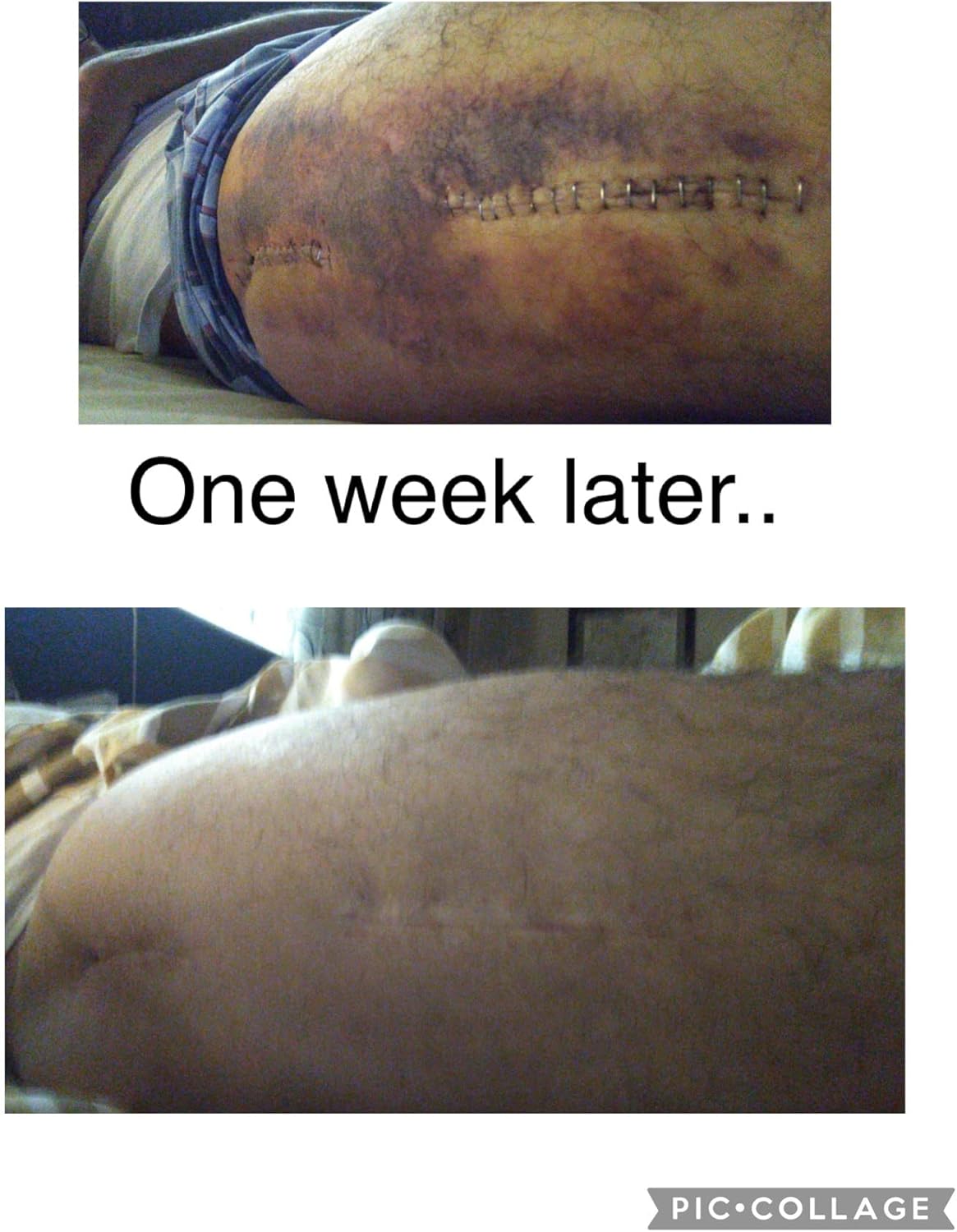 Amazing-O Oxygenating Nutritional Supplement from Stabilized Liquid Ozone, Oxygen Ions and Electrolytes. Amazing-O Improves Nutrient Absorption and Boosts Energy. Concentrated [2 Oz].