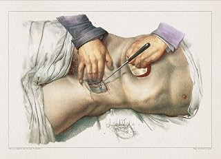 Anatomy EXTERNAL ILIAC ARTERY print SRA3 12x18 conqueror laid paper