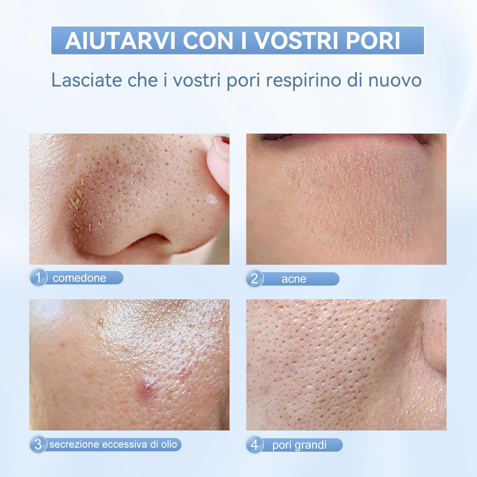 ANLAN Ultrasuoni Pulizia Viso Professionale,Facial Skin Scrubber Impermeabile a luce rossa e blu