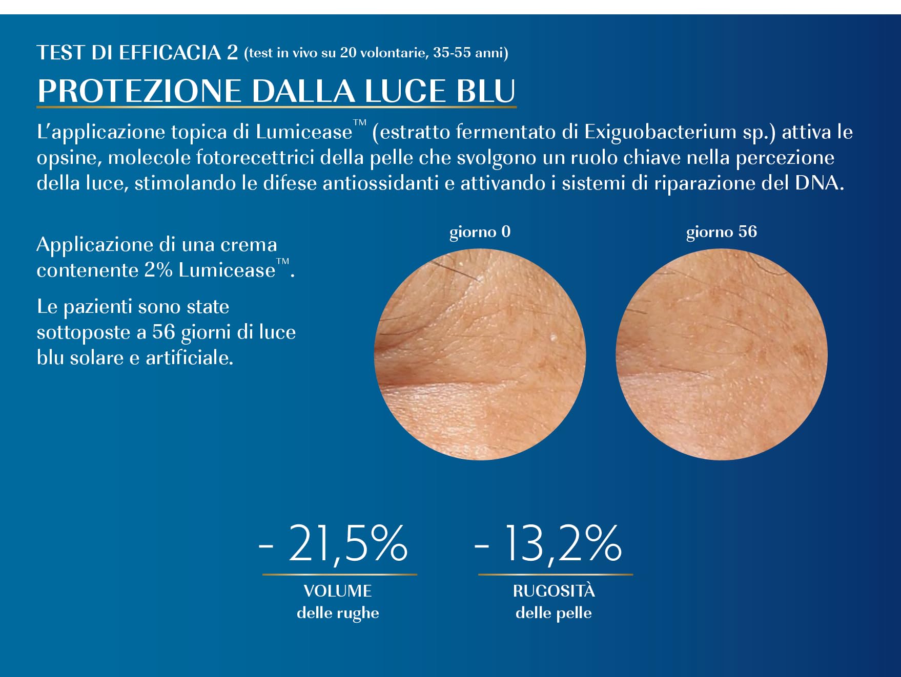 AGEX by PHARCOS® Blue Shield - Crema antiage distensiva delle rughe con filtro per la luce blu
