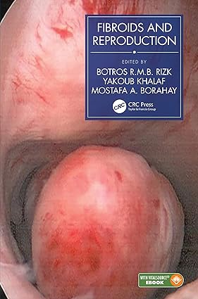 FIBROIDS AND REPRODUCTION (HB 2021)