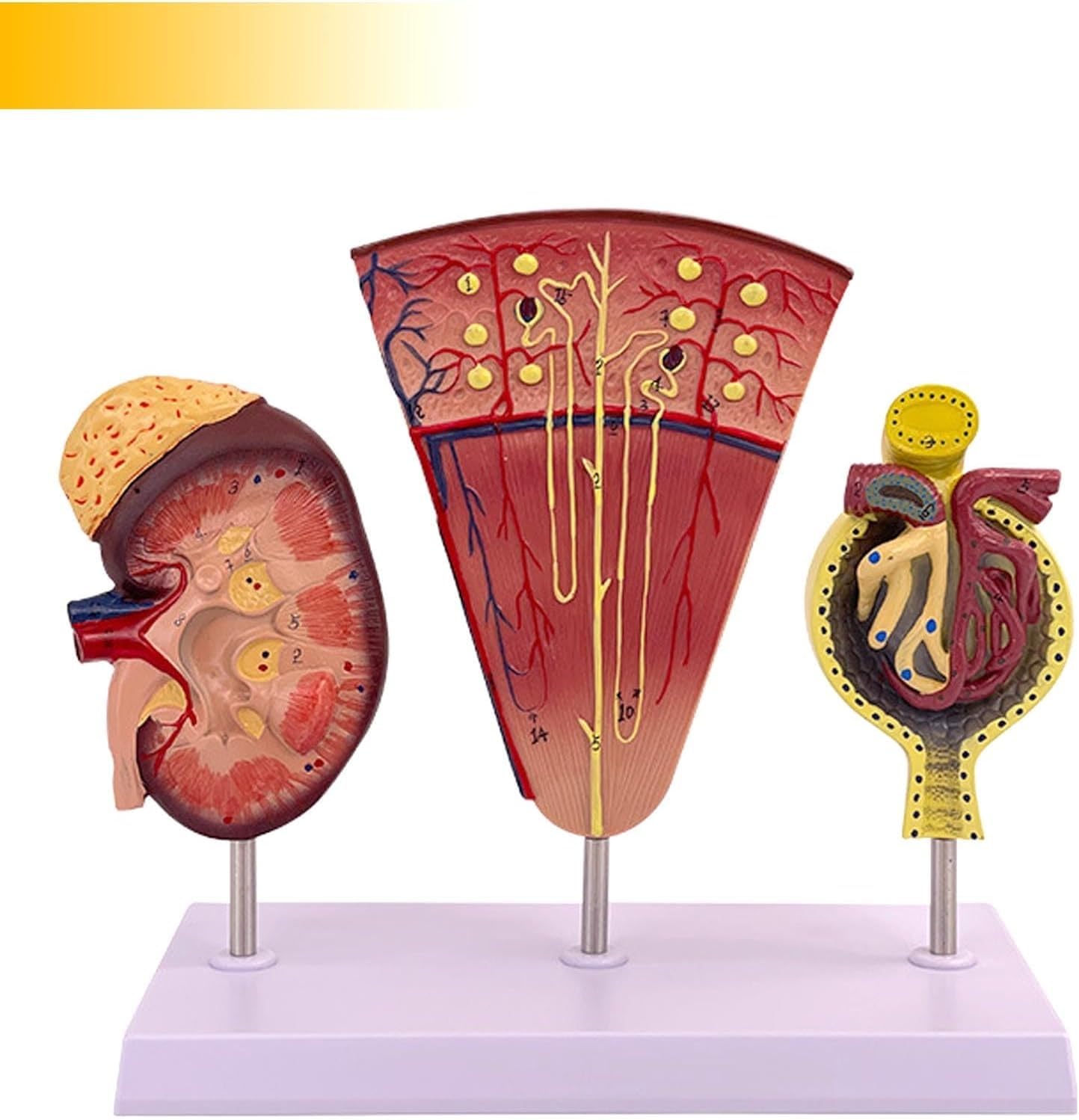 Model anatomiczny ludzkiej nerki, 3-częściowy powiększony model anatomiczny struktury kłębuszków nerkowych, służący do zademonstrowania budowy i funkcji nerek.