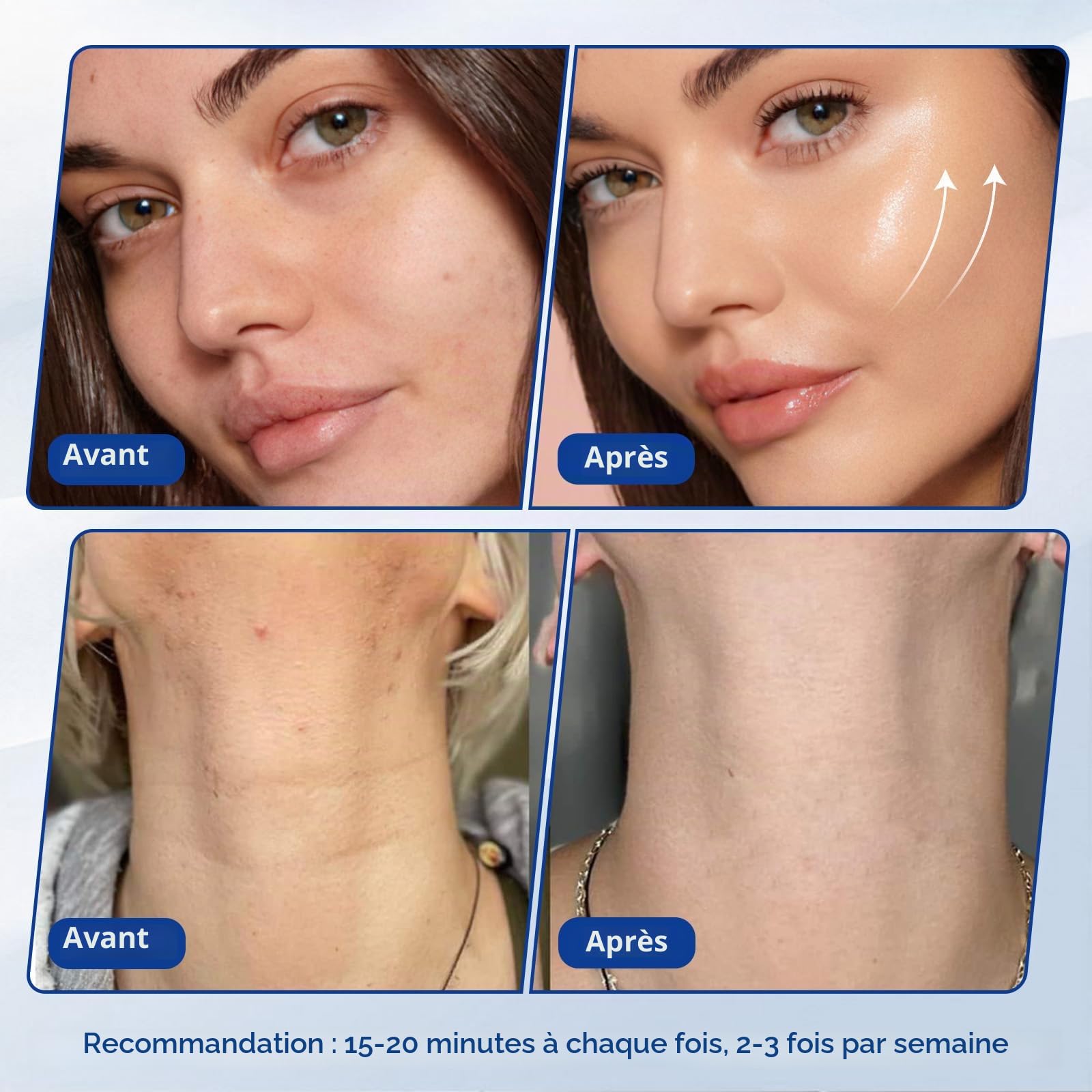 Cellulite 3-en-1 40K Cavitation et radiofréquence | RF 9 niveaux, ventouses visage et corps, facile et confortable à la maison
