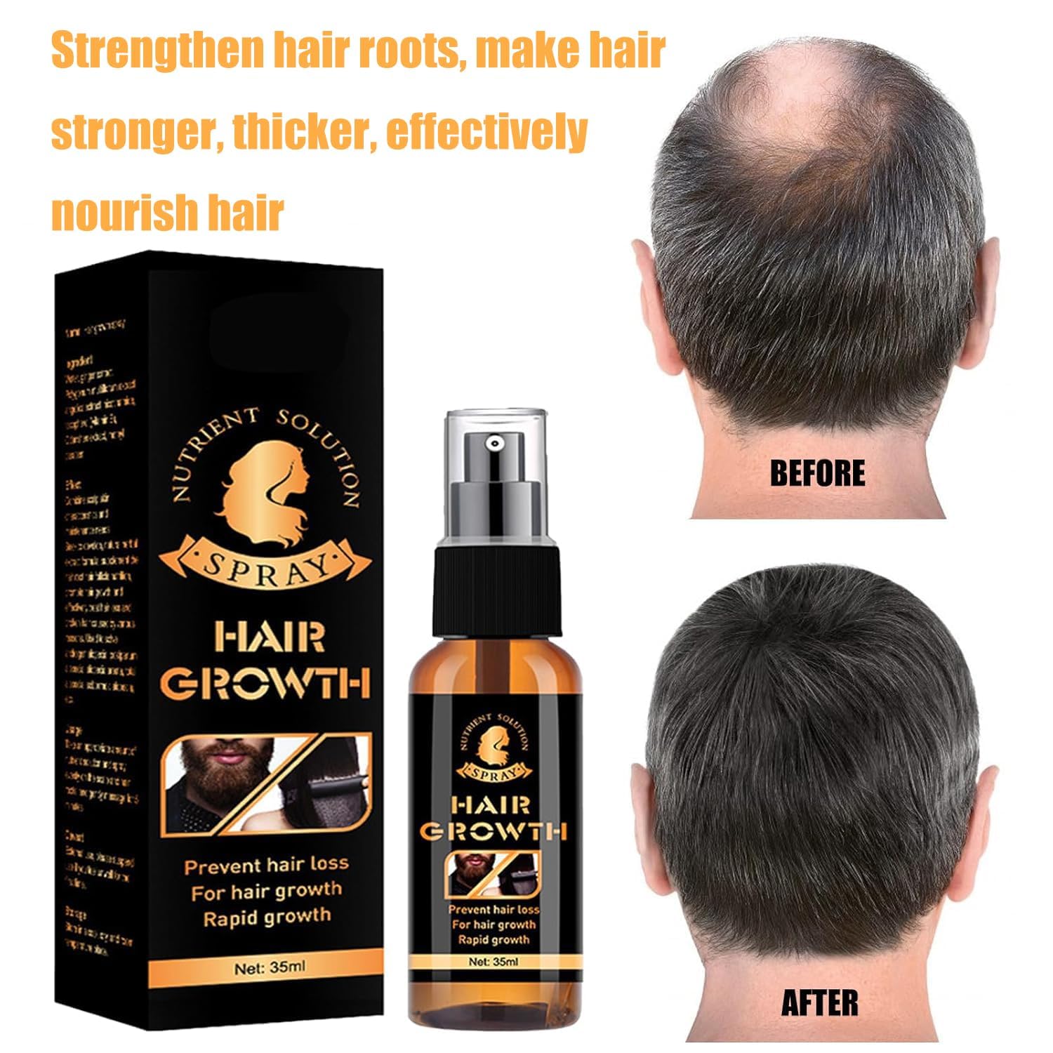 Premium-Biotin-Haar- und Bart-Booster, Premium-Biotin-Haar- und Bart-Spray-Booster für Männer, Haarwuchs-Serum-Spray für Haare und Bart, Bartspray, Bartwuchs