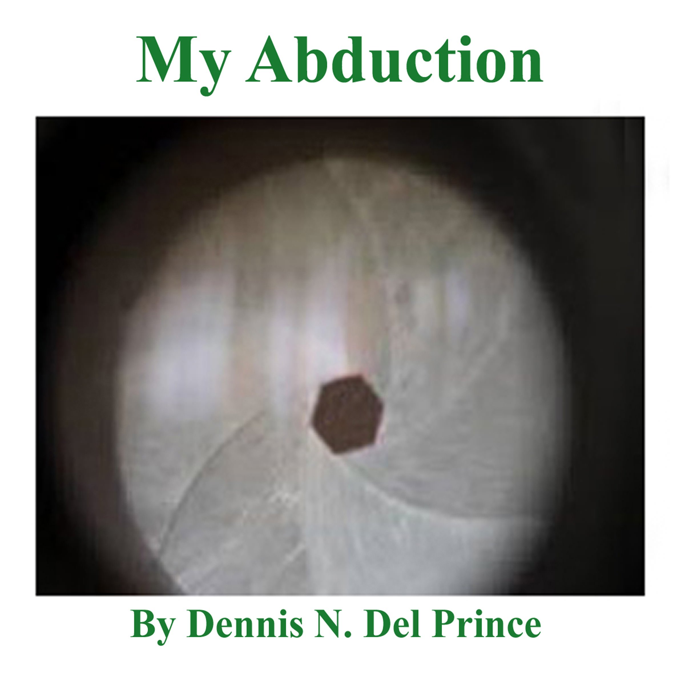 My Abduction
