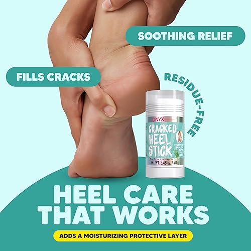 Miniatura 3 de Bálsamo en Barra Onyx Professional para Reparar Talones Agrietados, Aroma a Árbol de Té y Eucalipto, 1 Paquete - Tratamiento para Talones Secos y