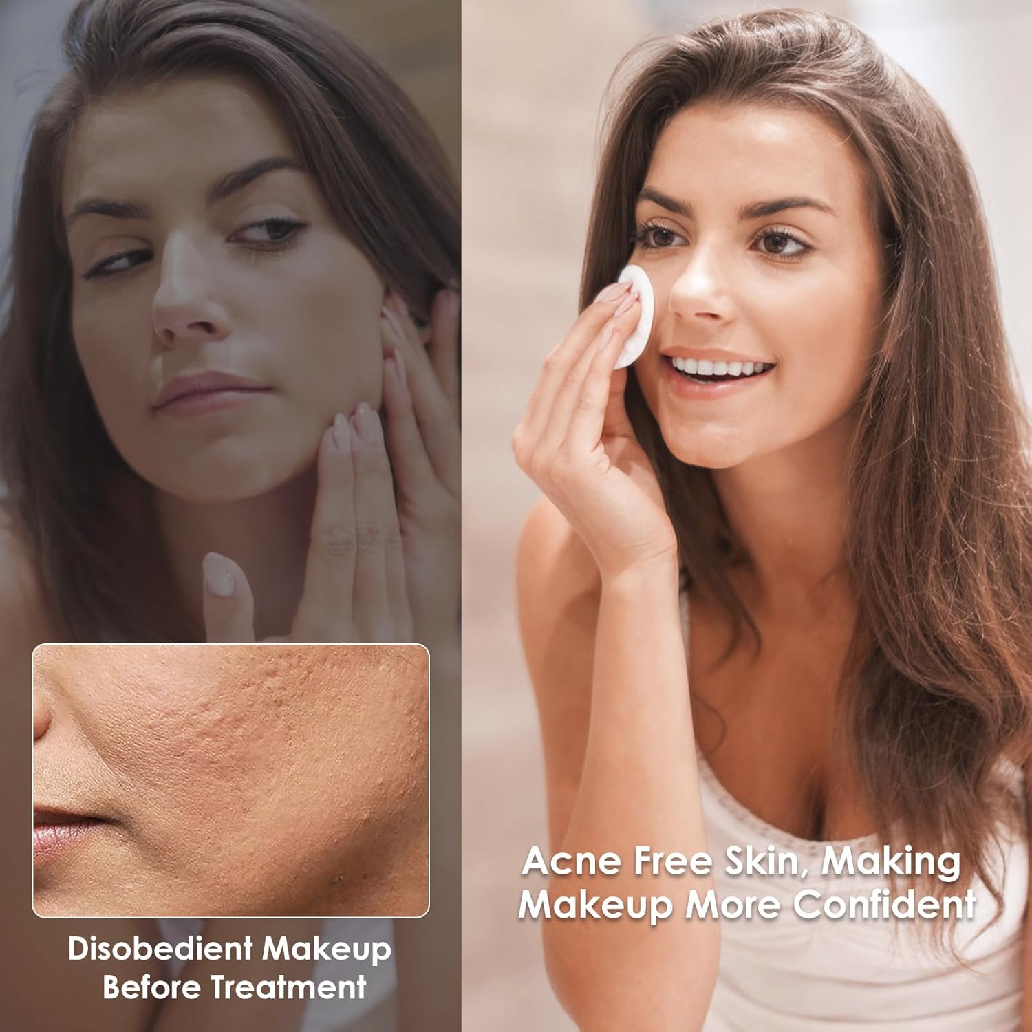 LED Face Msk (model FM-01), 7 Color LED Msk Light Therpy, Skin Care Msk for Face and Neck