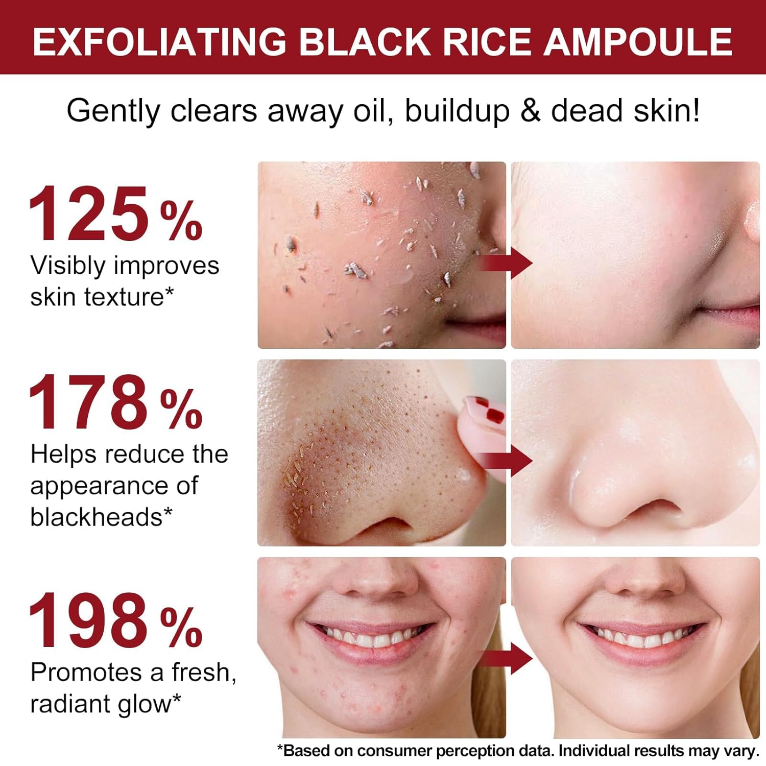 Black Rice Exfoliant and White Rice Ampoule Exfoliant, Peel Shot Glow Exfoliating Face Serum, Korean Skin Care Soft Exfoliating Body Scrub Dead Skin Cells, Blackheads Remover For All Skin Types 100ml - Image 4