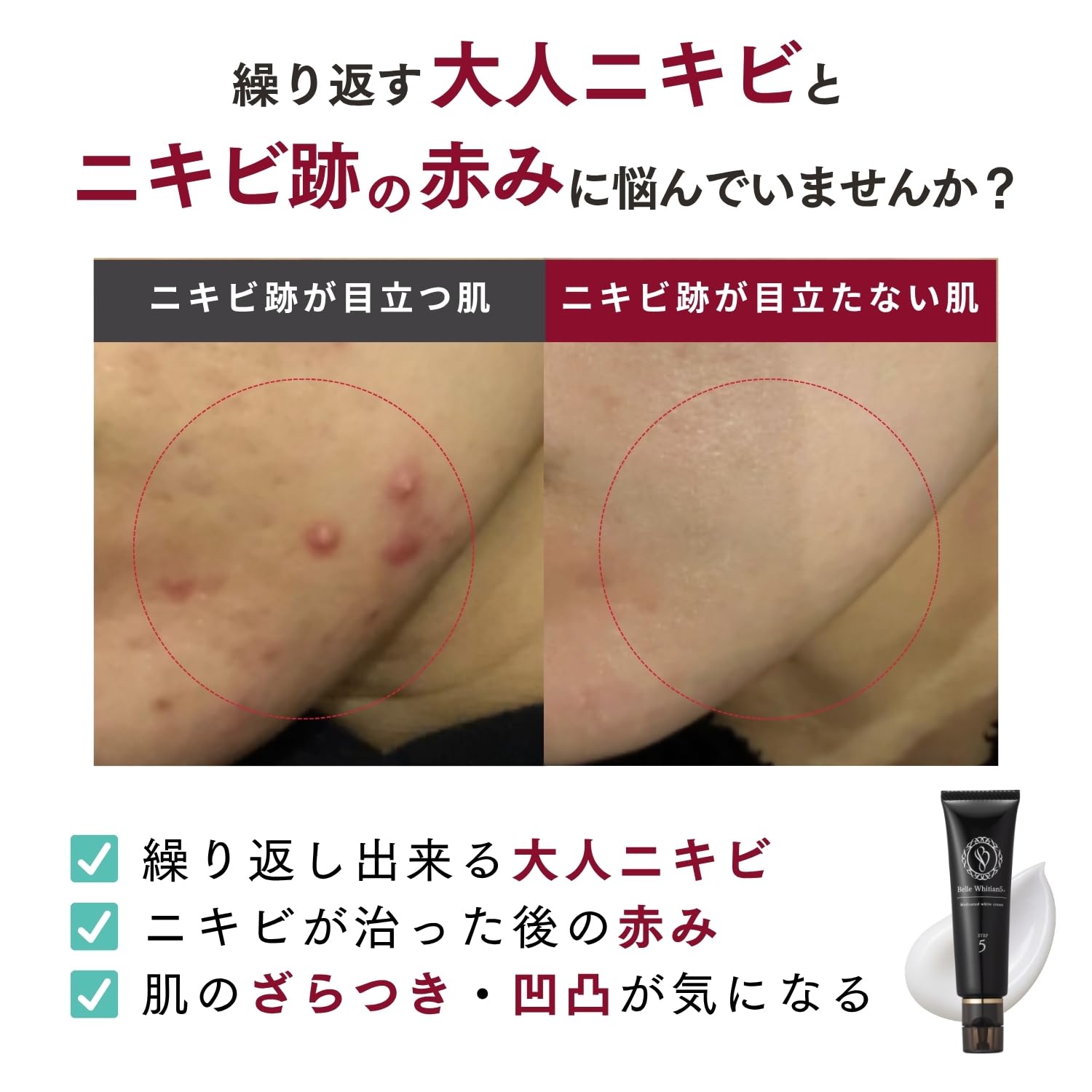 ベルホワイティアン Belle Whitian Cream x 5 ベルホワイティアン5＋