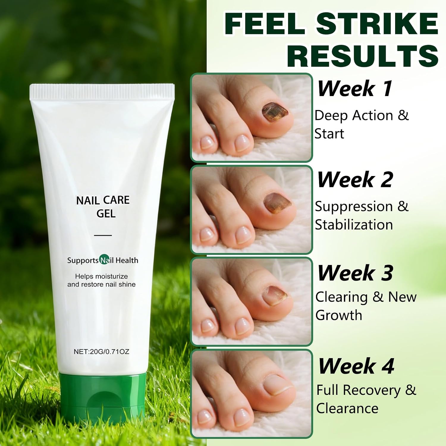 2pcs Natural Nail Repair Care Gel,Nutraboost Strengthening Cuticle Serum Nail Repair Gel,Nail Growth Repair Cream,Treatment Gels,Nail Growth Serum For Repair & Strengthener