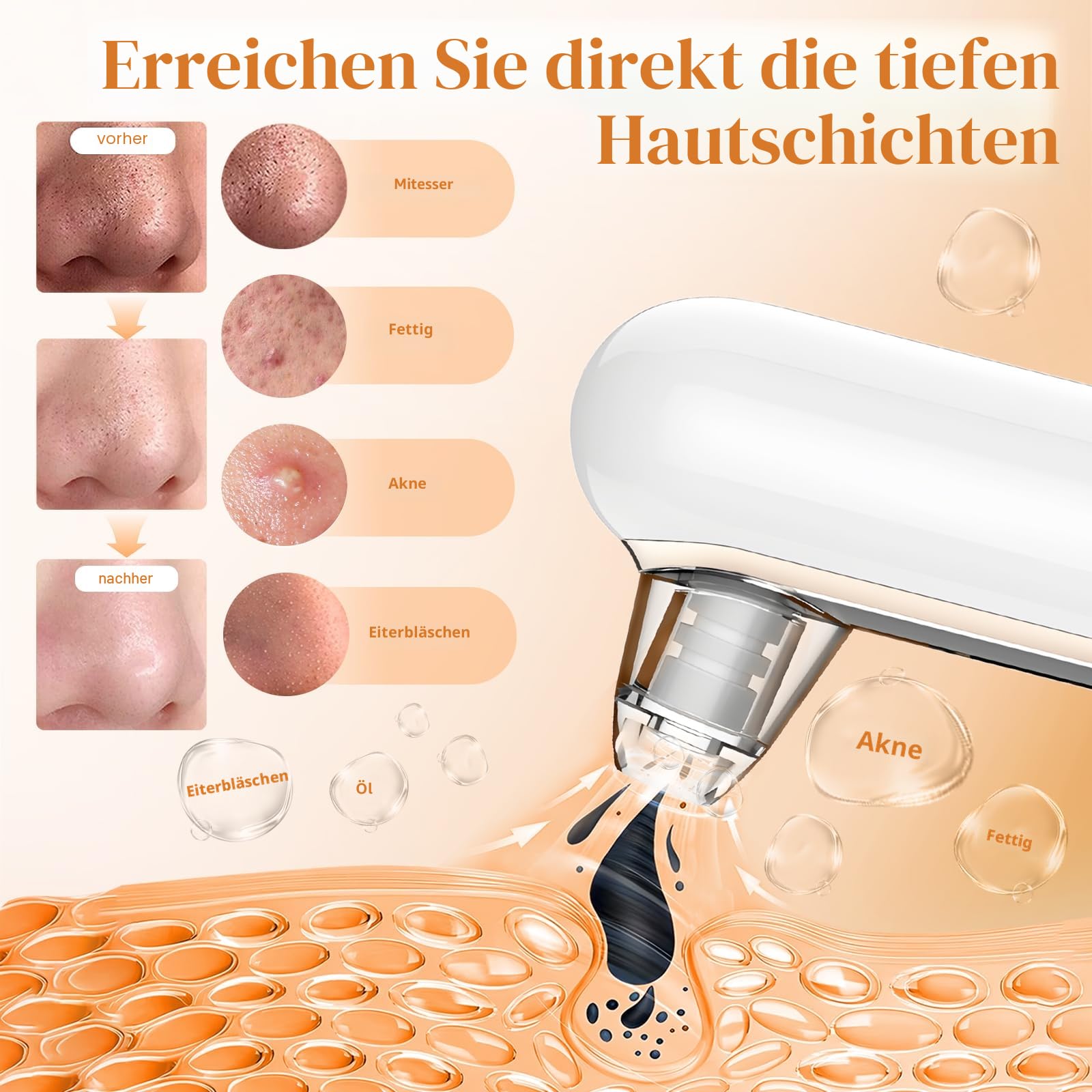 Yccu Mitesserentferner Porenreiniger 4 Modi Vakuumsauger Gesichtsreinigung Akne Behandlung