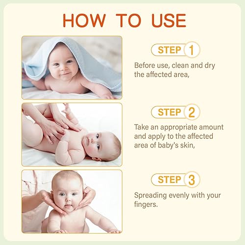 Miniatura 5 de Crema para eccema para bebés, terapia y alivio del eccema para niños, crema corporal nutritiva para la piel, alivia y alivia la sequedad,