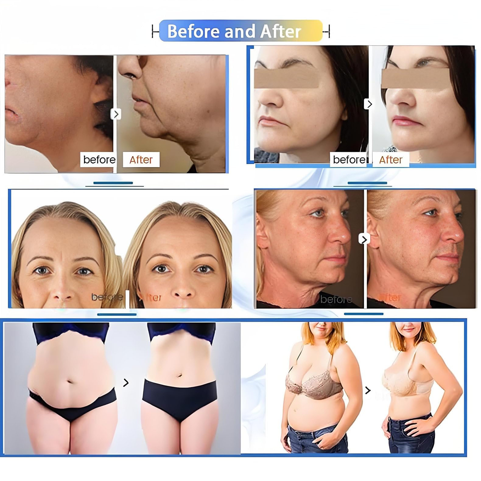 7 in 1 Macchina Rassodante per Rimozione Delle Rughe, Macchina Rassodante per Viso E Corpo Con 7 Cartucce, Macchina Di Bellezza per Perdita Di Peso Con Lifting Facciale per Uso in Salone Domestico