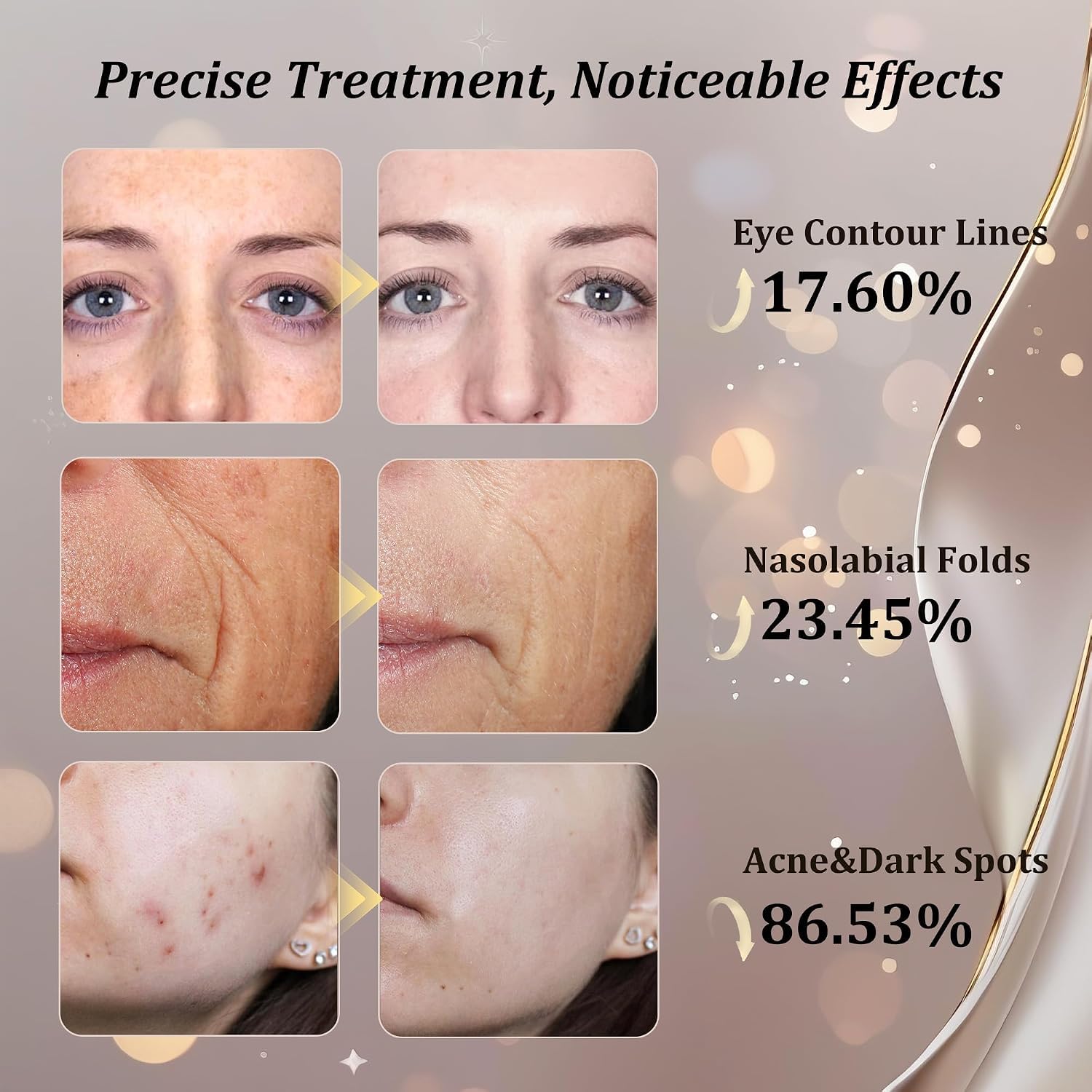 CUEME Rotlichttherapie für Gesicht, FDA-klare LED-Lichttherapie-Maske für Falten, Aknebehandlung und Hautpflege, tragbare Gesichtsmaske für Frauen – Mutter, Schwester, Freundin und Ehefrau