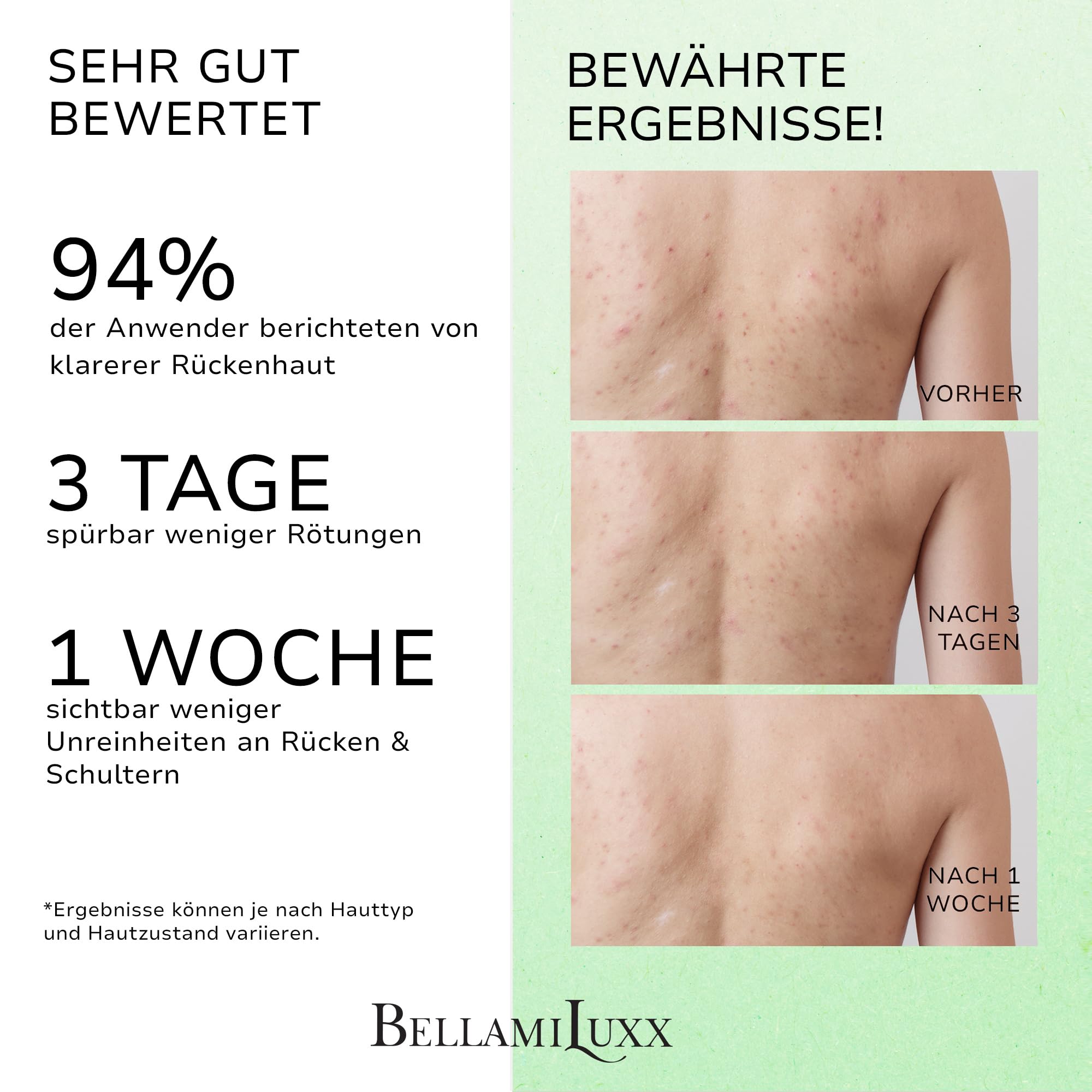 BellamiLuxx 3-stufiges Rücken- & Körper-Aknepflege-Set – Seifenstück, Peeling & Rücken-Spray – Für unreine Haut an Rücken, Brust & Schultern – Hilft bei Pickeln, verstopften Poren & Hautunebenheiten