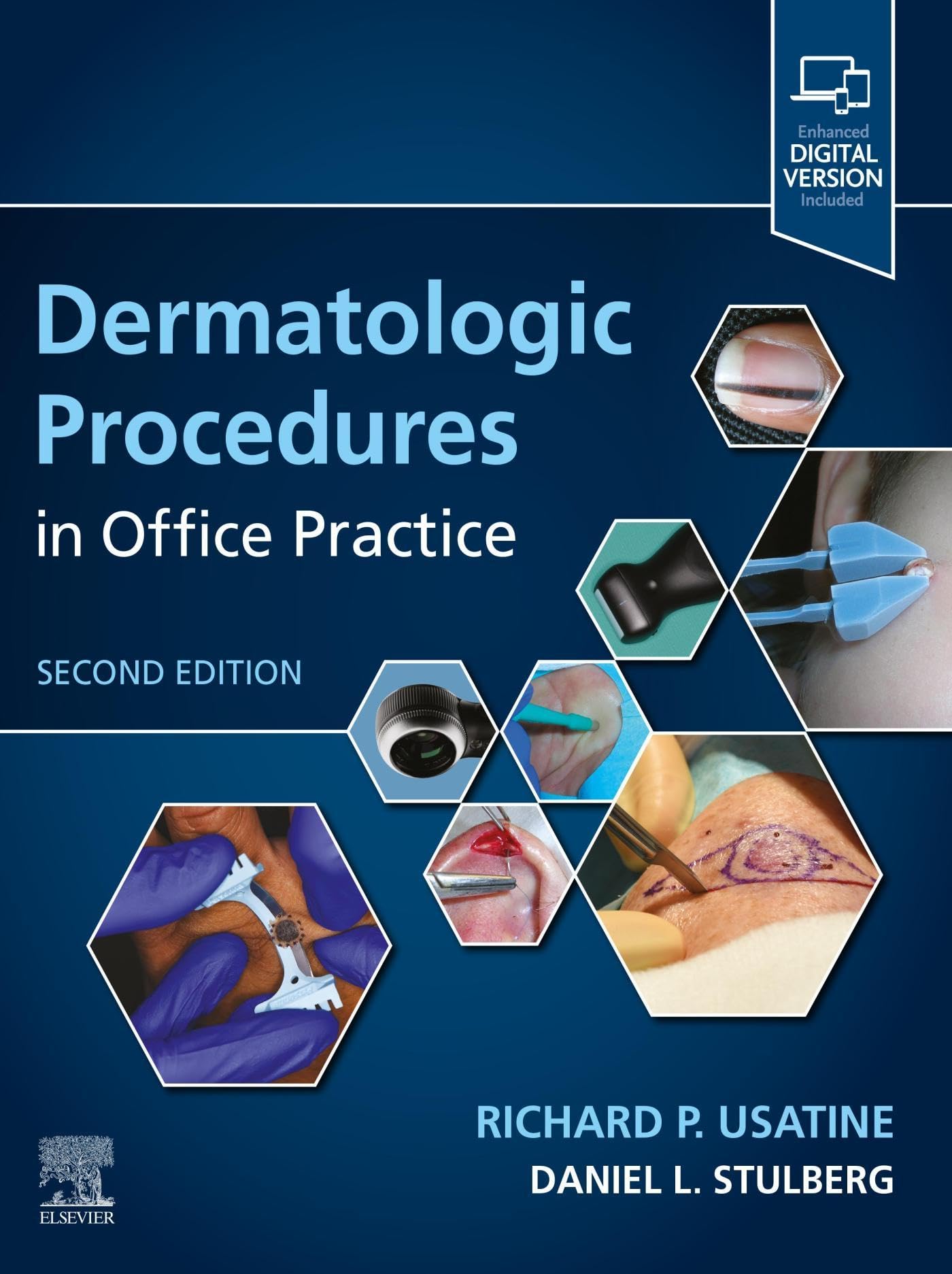 Dermatologic Procedures in Office Practice - E-Book (English Edition)